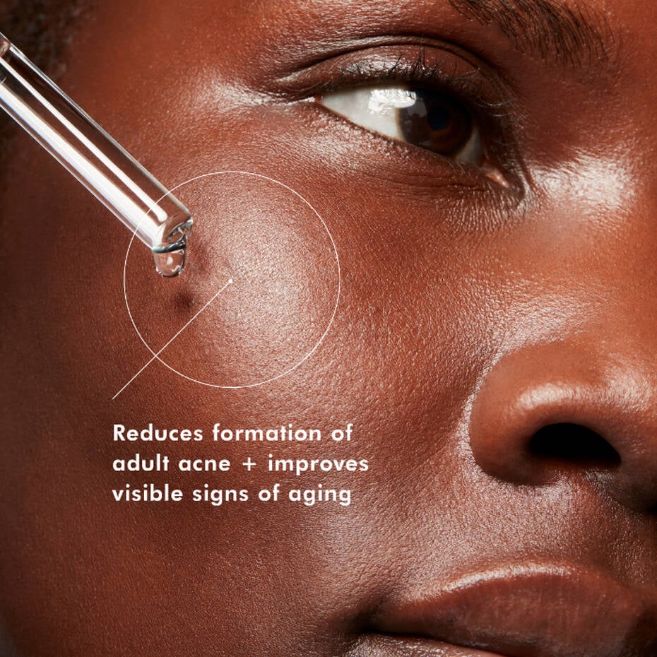 Blemish + Age Defense Serum | SkinCeuticals