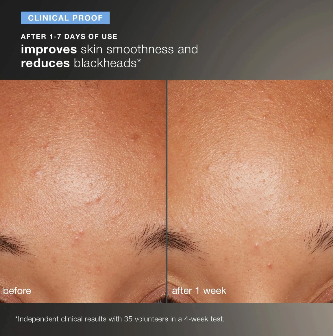 Daily Microfoliant | Dermalogica