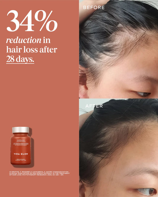 Hairology | Vida Glow